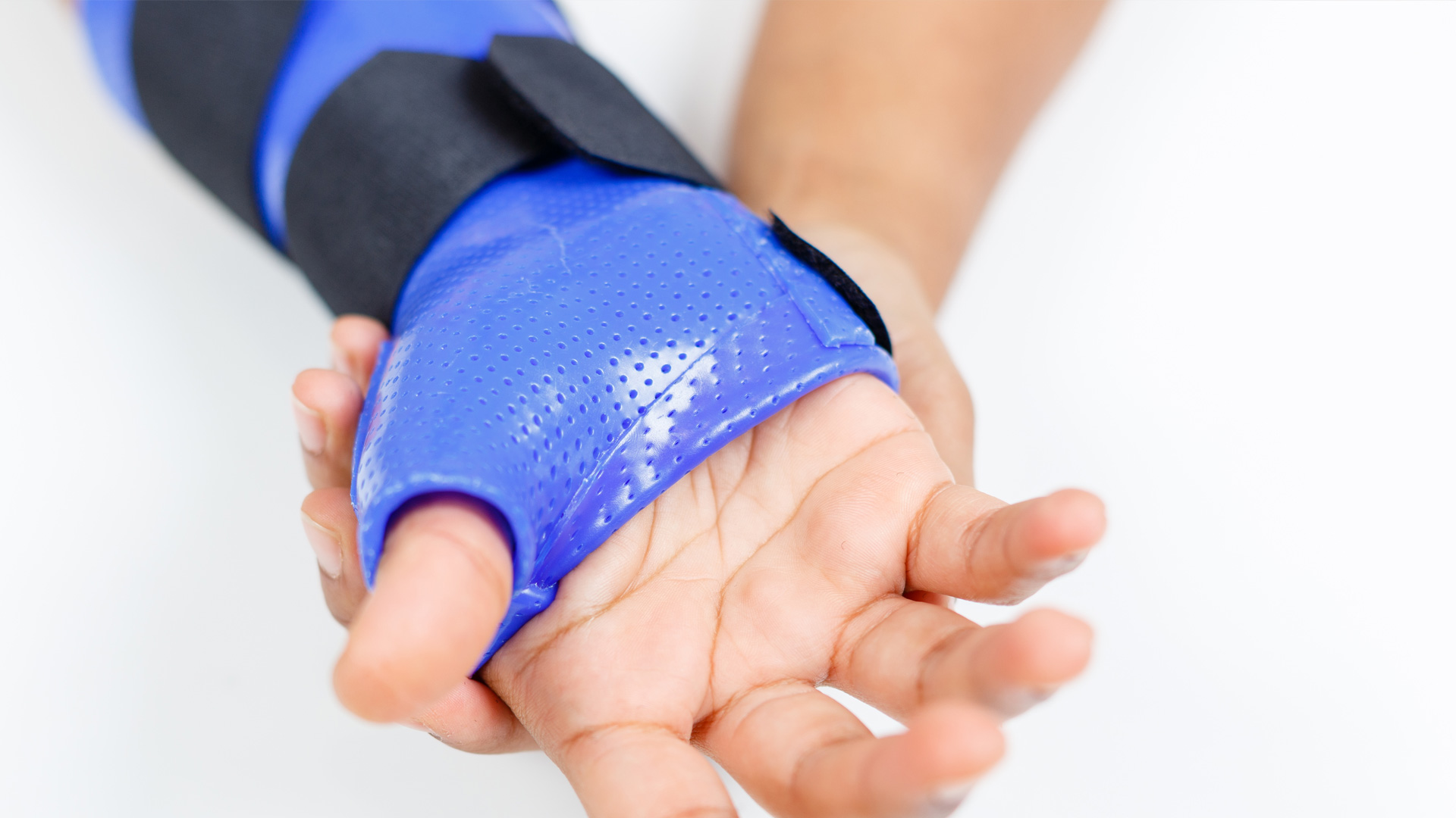 HTC Custom-made splints
